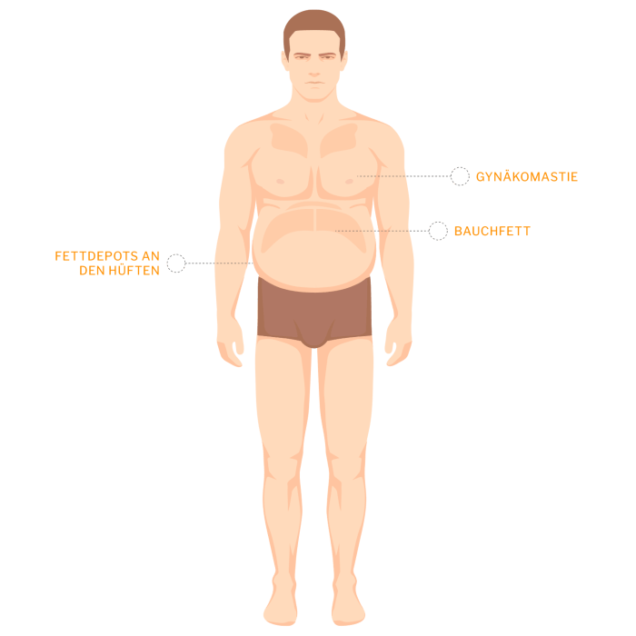 liposuktion mann